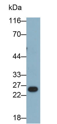 Monoclonal Antibody to Interleukin 1 Beta (IL1b)