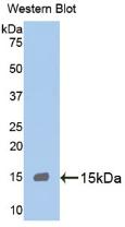 Monoclonal Antibody to Myeloperoxidase (MPO)