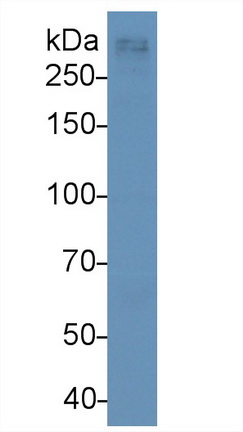 Monoclonal Antibody to Apolipoprotein <b>B100</b> (APO<b>B100</b>)