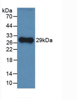 Monoclonal Antibody to Complement Factor H (CFH)