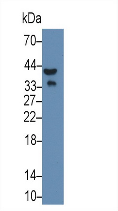 Monoclonal Antibody to Apolipoprotein E (APOE)