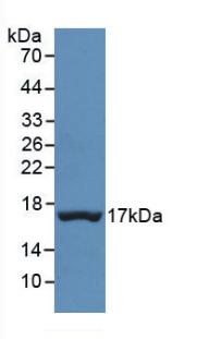 Monoclonal Antibody to Prealbumin (PALB)