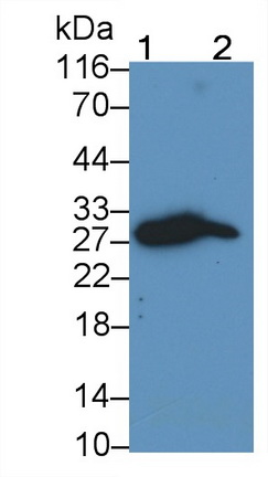 Monoclonal Antibody to Programmed Cell Death Protein 1 (PD1)