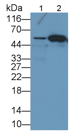 Monoclonal Antibody to Forkhead Box Protein P1 (FOXP1)