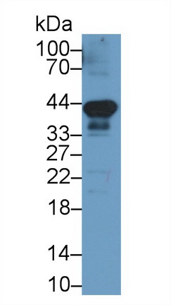 Monoclonal Antibody to Programmed Cell Death Protein 1 Ligand 1 (PDL1)