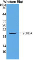 Monoclonal Antibody to Alpha-1-Acid Glycoprotein (a1AGP)