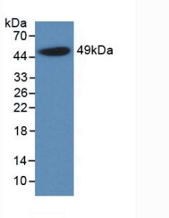 Monoclonal Antibody to Alpha-1-Acid Glycoprotein (a1AGP)