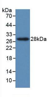 Monoclonal Antibody to Parathyroid Hormone Related Protein (PTHrP)