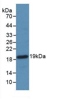 Monoclonal Antibody to Coagulation Factor II (F2)