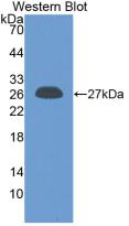 Monoclonal Antibody to C Reactive Protein (CRP)