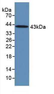 Monoclonal Antibody to Follicle Stimulating Hormone (FSH)