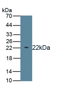 Monoclonal Antibody to Von Willebrand Factor (vWF)