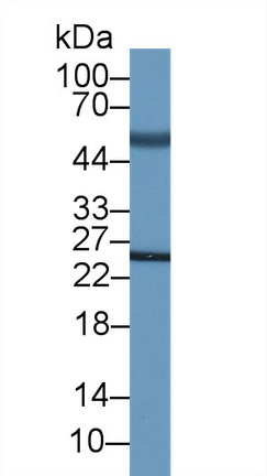 MAA836Hu21.jpg