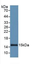 Monoclonal Antibody to Serum Amyloid A (SAA)