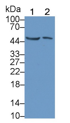 Monoclonal Antibody to Tumor Protein p53 (P53)