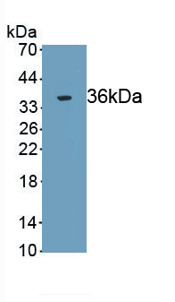 Monoclonal Antibody to Tumor Protein p53 (P53)