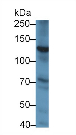 Monoclonal Antibody to Procollagen I N-Terminal Propeptide (PINP)