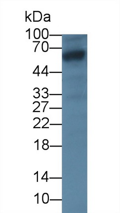 Monoclonal Antibody to Glypican 3 (GPC3)