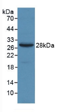 MAB017Hu22.jpg