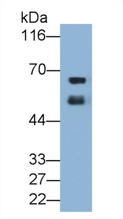 Monoclonal Antibody to Albumin (ALB)