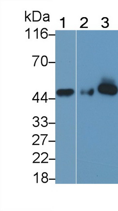 Monoclonal Antibody to Surfactant Associated Protein D (SPD)