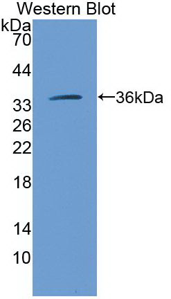 Monoclonal Antibody to Arginase (ARG)