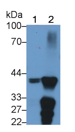 Monoclonal Antibody to Arginase (ARG)