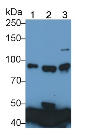 Monoclonal Antibody to Transferrin Receptor (TFR)