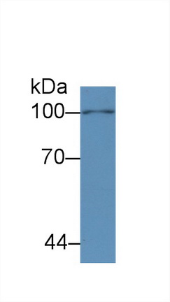 Monoclonal Antibody to Transferrin Receptor (TFR)