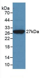 MAB180Hu22.jpg