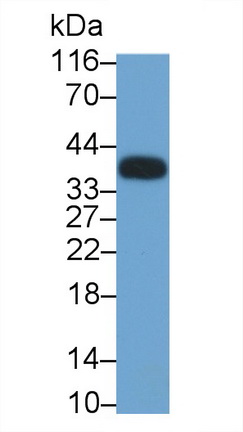 Monoclonal Antibody to Clusterin (CLU)