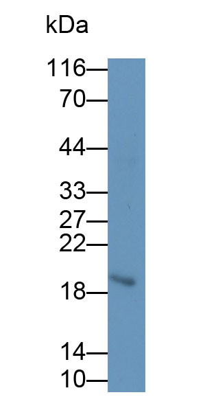 Monoclonal Antibody to Cytotoxic T-Lymphocyte Associated Antigen 4 (CTLA4)