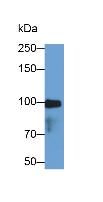 Monoclonal Antibody to Plasminogen (Plg)