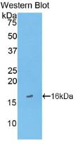 Monoclonal Antibody to Heart-type Fatty Acid Binding Protein (H-FABP)