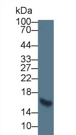 Monoclonal Antibody to Heart-type Fatty Acid Binding Protein (H-FABP)