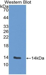 Monoclonal Antibody to Heart-type Fatty Acid Binding Protein (H-FABP)