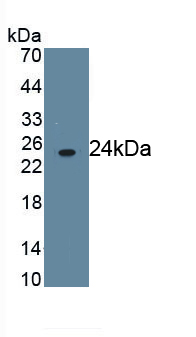 Monoclonal Antibody to Fc Fragment Of IgG Low Affinity IIIb Receptor (FcgR3B)