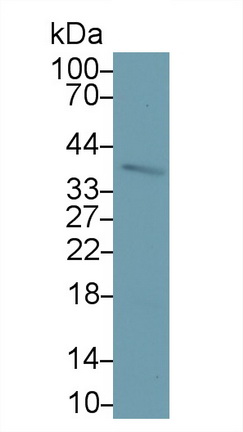 Monoclonal Antibody to Epithelial Cell Adhesion Molecule (EPCAM)