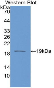 MAB316Hu22.jpg