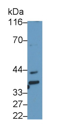 MAB334Hu21.jpg