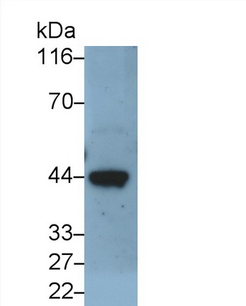 Monoclonal Antibody to Elastin (ELN)