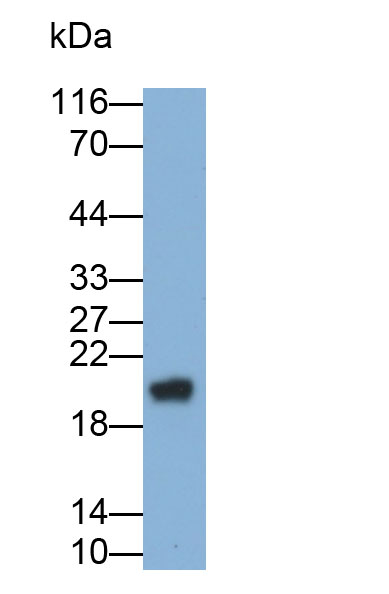 MAB375Hu21.jpg