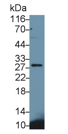 MAB382Hu23.jpg