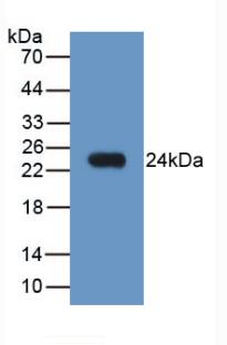 Monoclonal Antibody to Neutrophil gelatinase-associated lipocalin (NGAL)