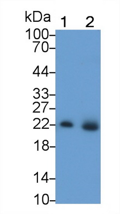 Monoclonal Antibody to Neutrophil gelatinase-associated lipocalin (NGAL)