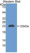 Monoclonal Antibody to Neutrophil gelatinase-associated lipocalin (NGAL)