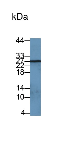 Monoclonal Antibody to Neutrophil gelatinase-associated lipocalin (NGAL)