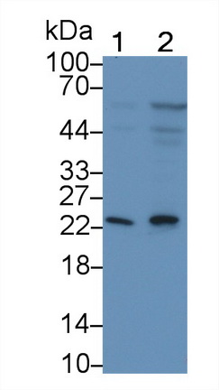 Monoclonal Antibody to Killer Cell Lectin Like Receptor Subfamily D, Member 1 (KLRD1)