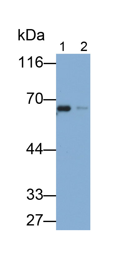 Monoclonal Antibody to Tyrosine Hydroxylase (TH)