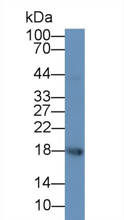 MAB612Hu21.jpg